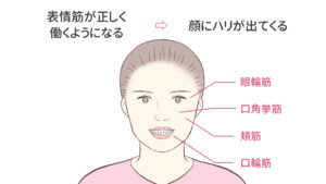 八重歯によるほうれい線は矯正治療で消える理由を徹底図解 キレイを叶える歯科矯正ロードマップ