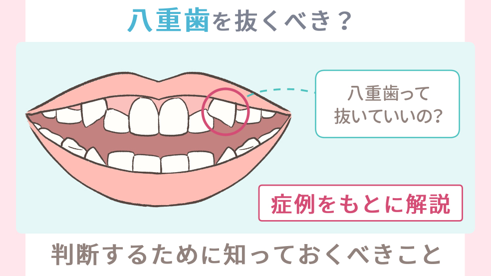 八重歯を抜くべきか を判断するために知っておくべき症例の特徴 キレイを叶える歯科矯正ロードマップ