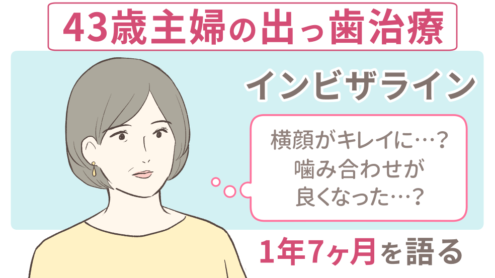 43歳主婦のインビザライン体験談 出っ歯を1年7ヶ月で治療完了 キレイを叶える歯科矯正ロードマップ